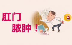 泉州痔疮创口微小手术选哪家医院